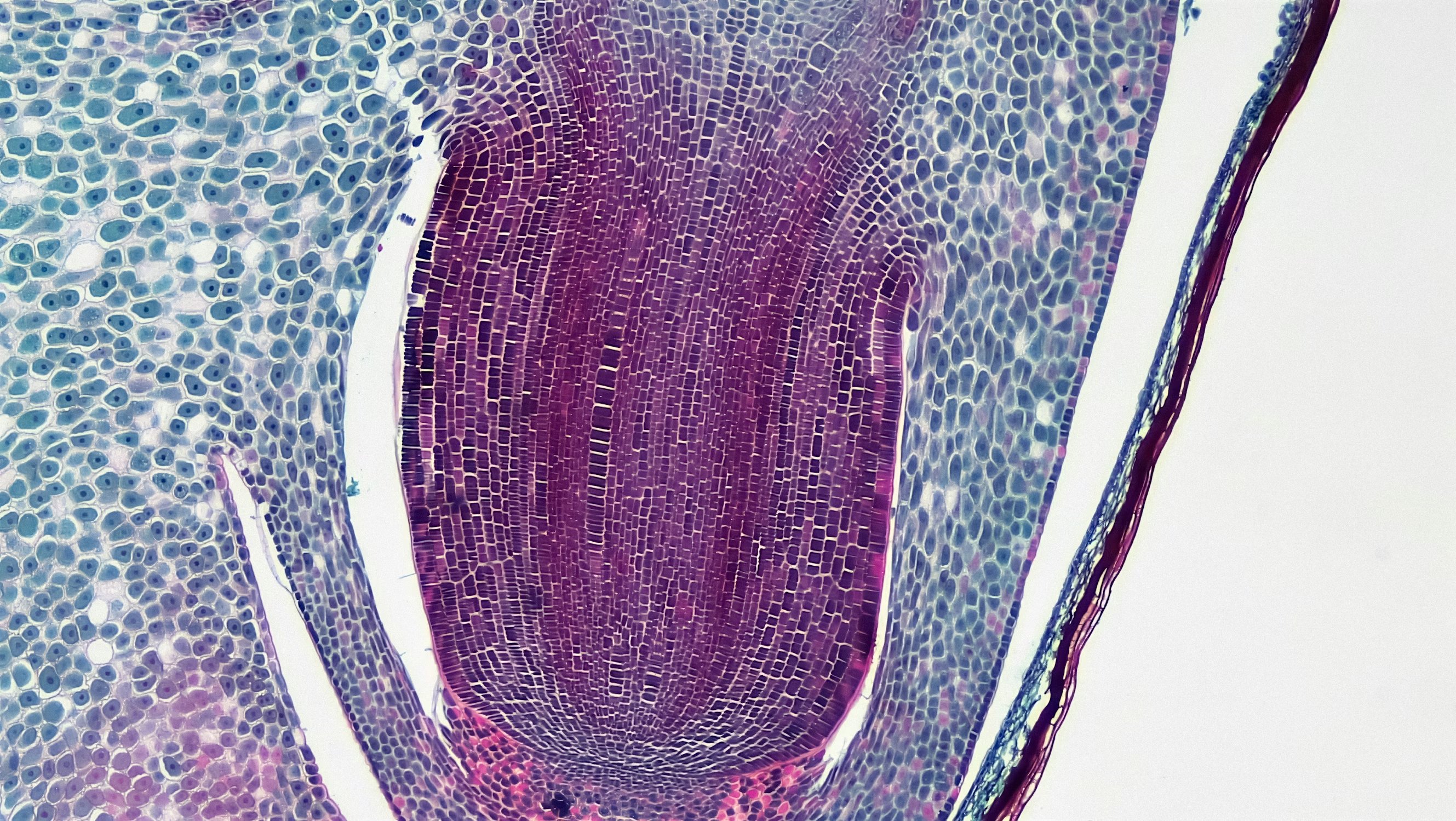 Radicle or Embryonic Root in Zea Mays Embryo cross section