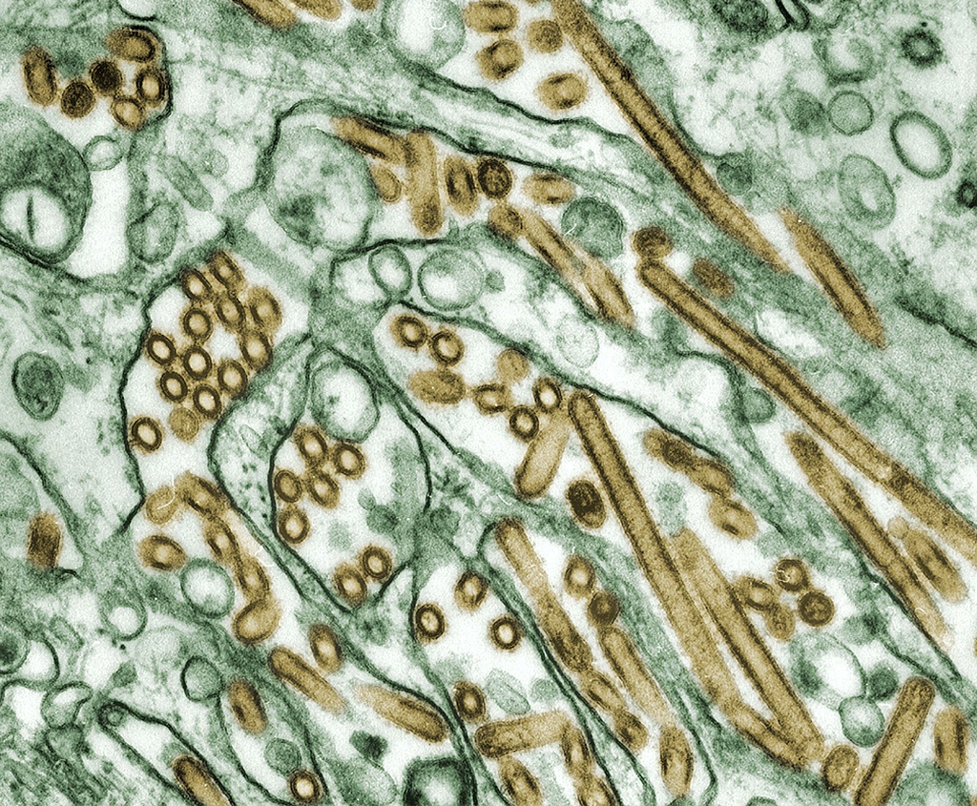 TEM image of Avian Influenza A H5N1 viruses