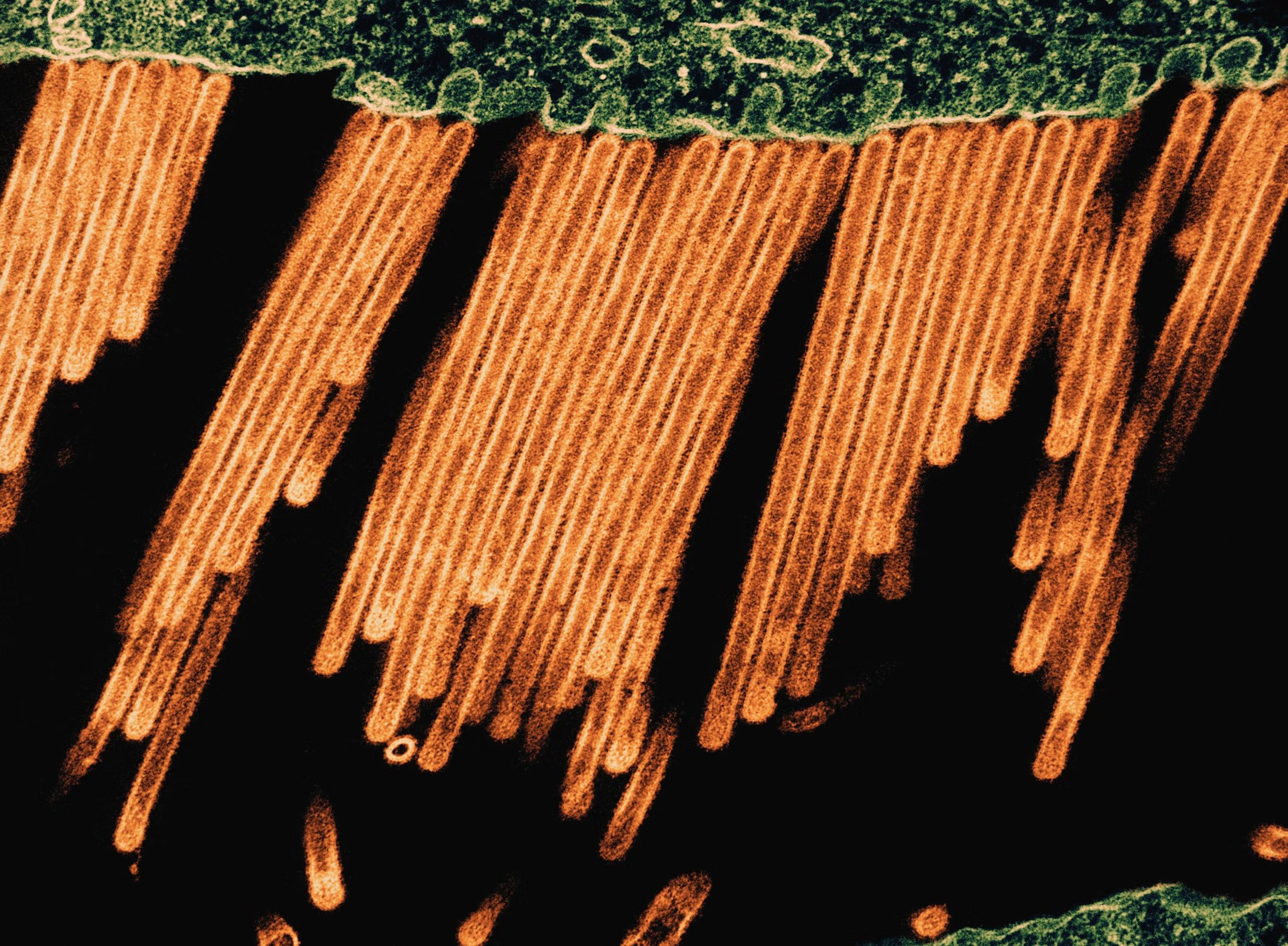 Influenza A Virus (SW31) Colorized