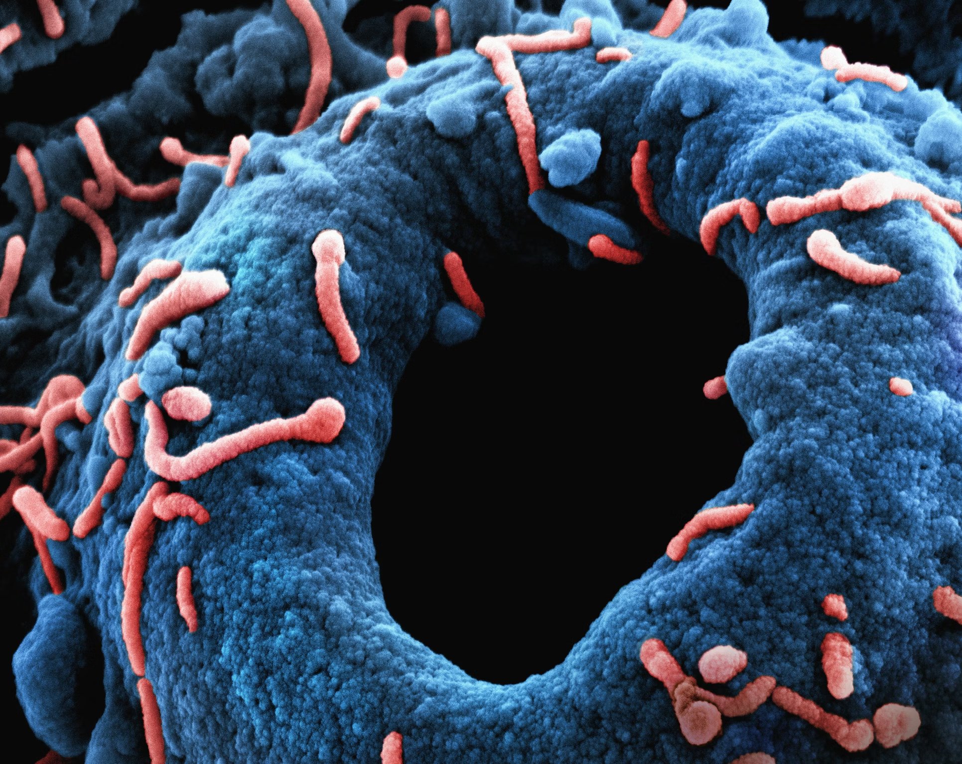 Marburg Virus Particles Colorized scanning
