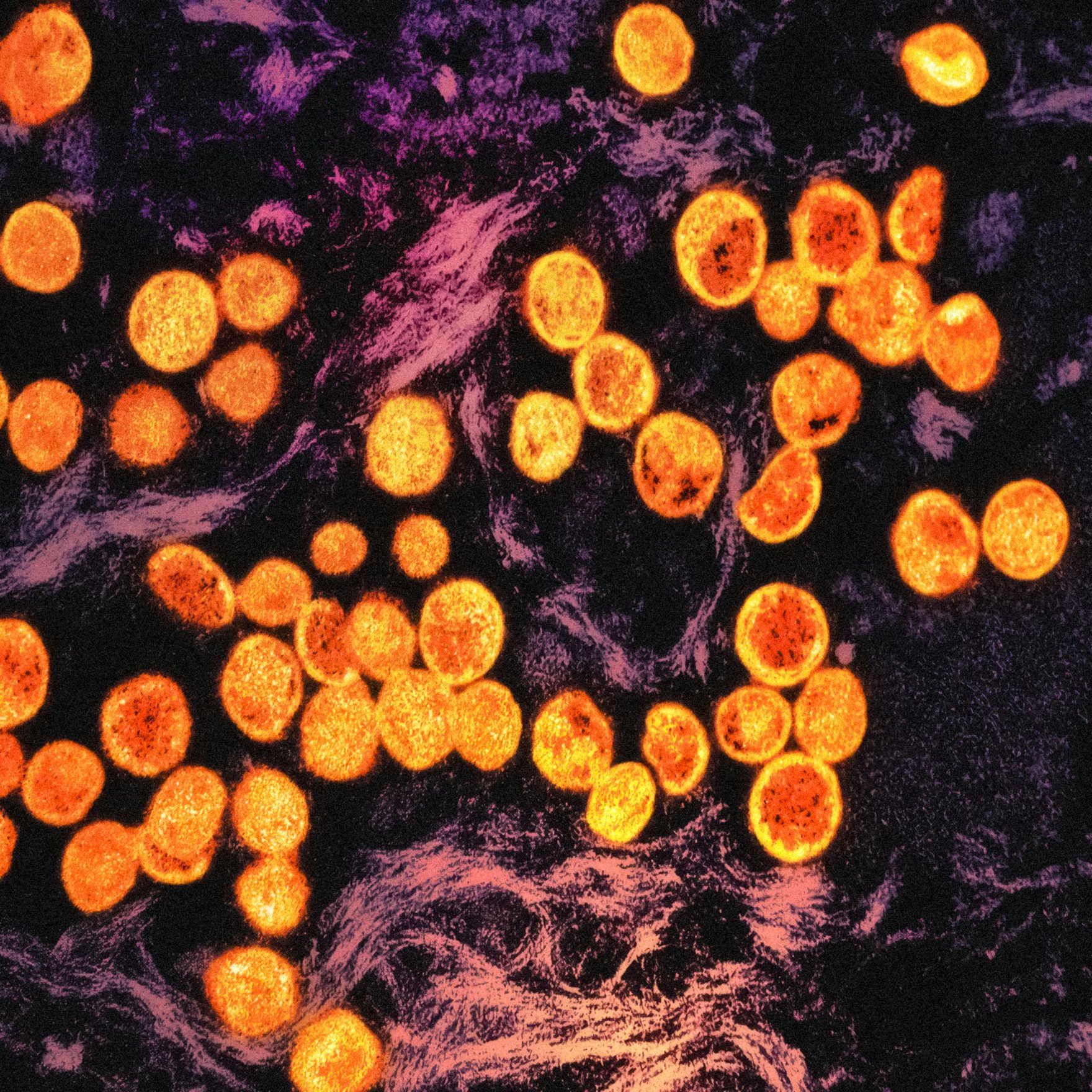 Mpox Virus Transmission