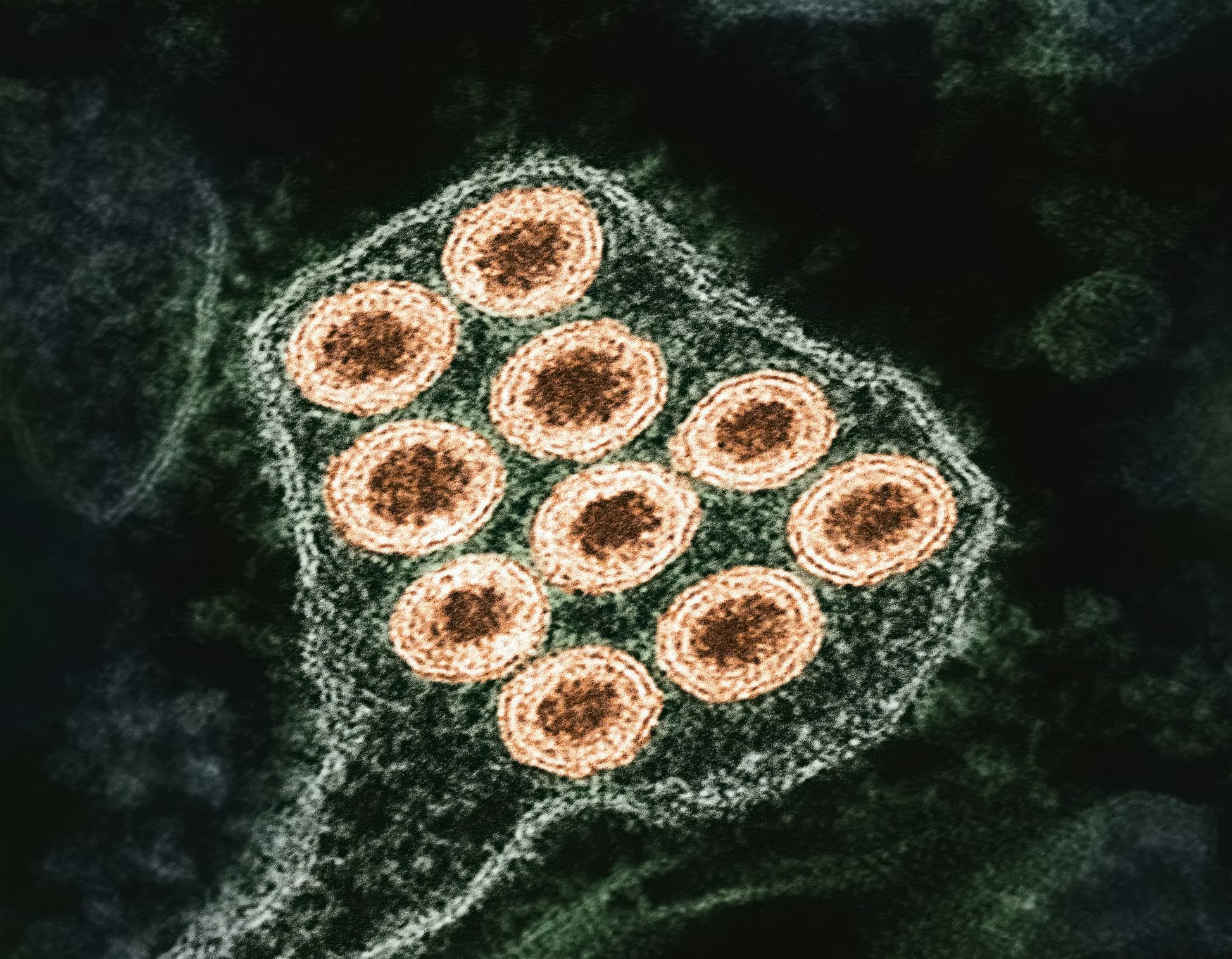 Rabies Virus Colorized