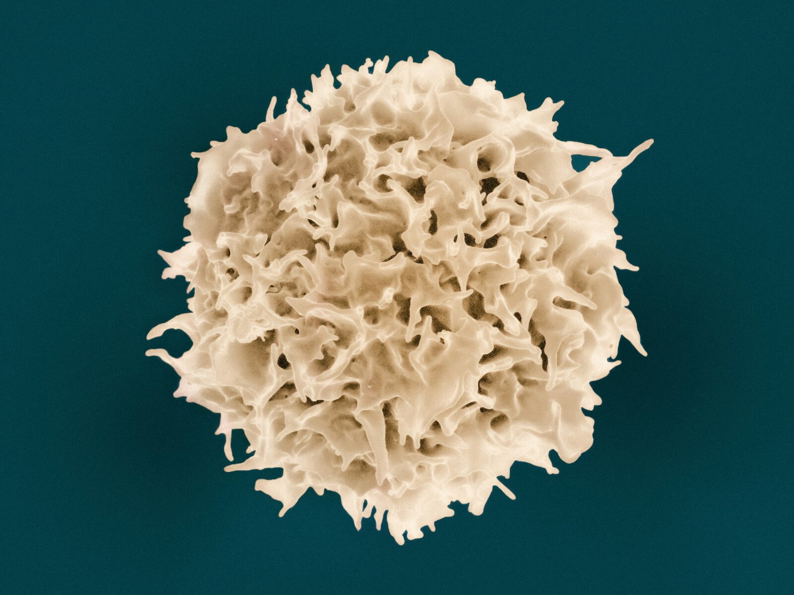 T lymphocyte